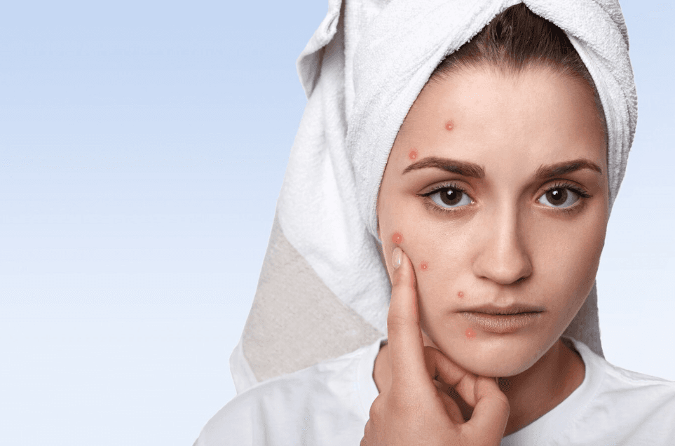 Skin Conditions